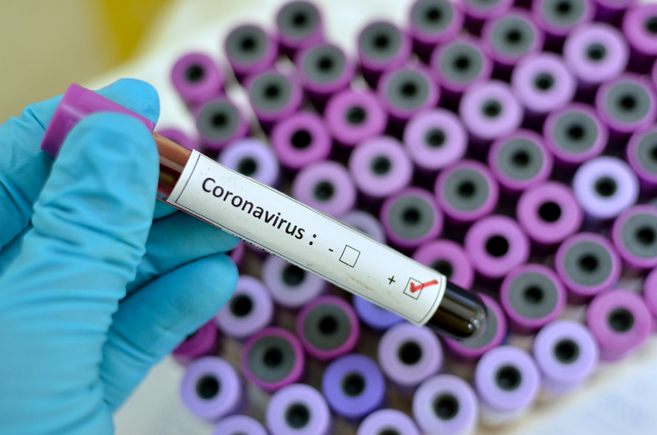 Intensyvesnis testavimas dėl koronaviruso – keturiose savivaldybėse